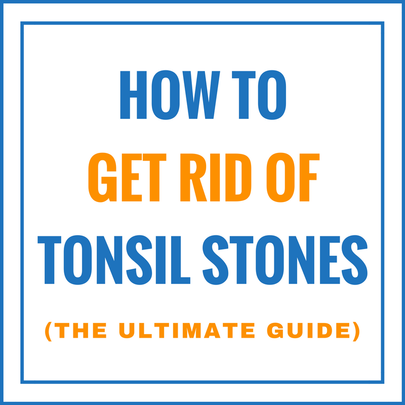 How To Get Rid Of Tonsil Stones: The Ultimate Guide