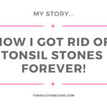 How I Got Rid Of Tonsil Stones Forever