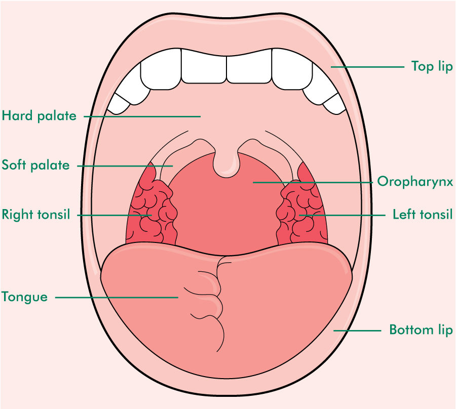 Mouth Diagram: How To Check For Tonsil Stones