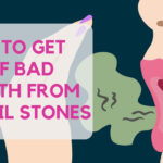 Bad Breath From Tonsil Stones