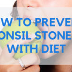 Tonsil Stone Prevention Diet