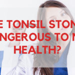 Are Tonsil Stones Dangerous To My Health?