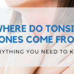 Where Do Tonsil Stones Come From
