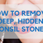 how to remove deep, hidden tonsil stones