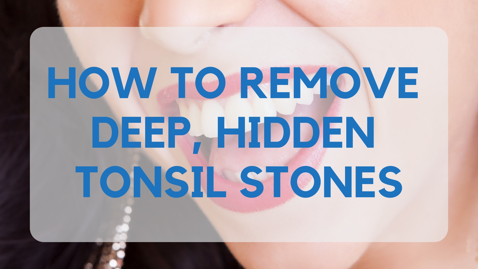 How To Remove Deep, Hidden Tonsil Stones - TonsilStoneCure