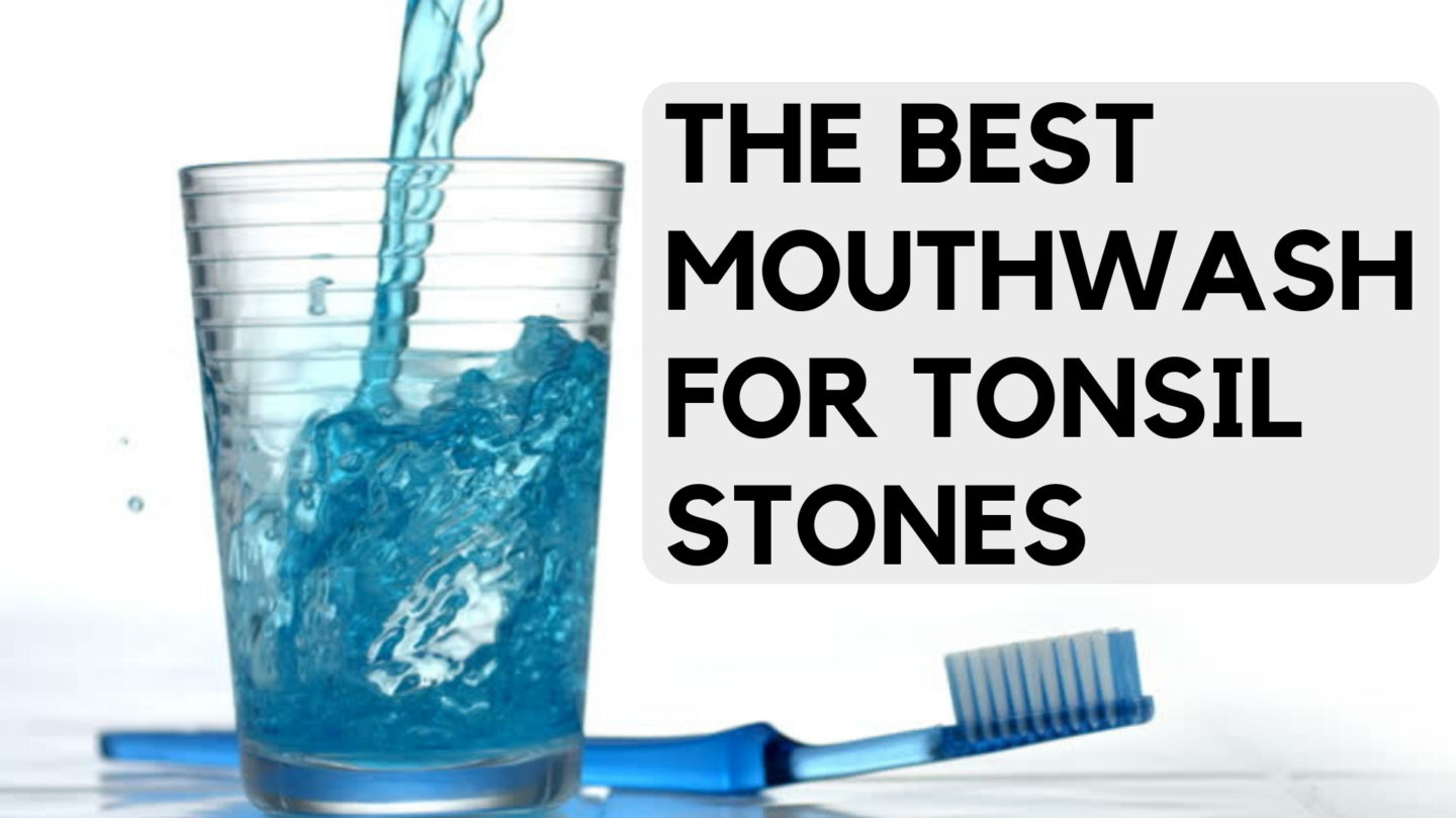 Pot tonsil stones