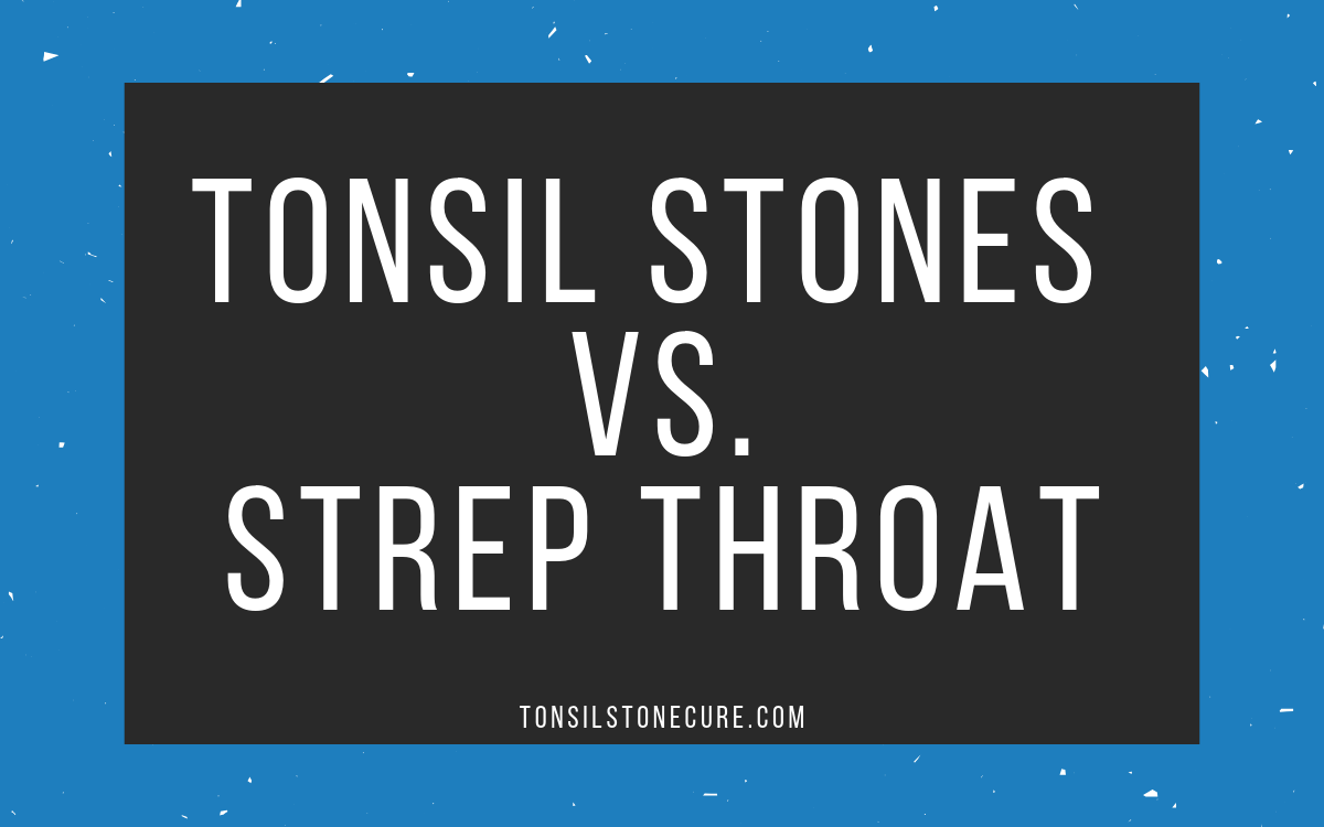 tonsil-stones-or-strep-throat-how-to-tell-the-difference-tonsilstonecure